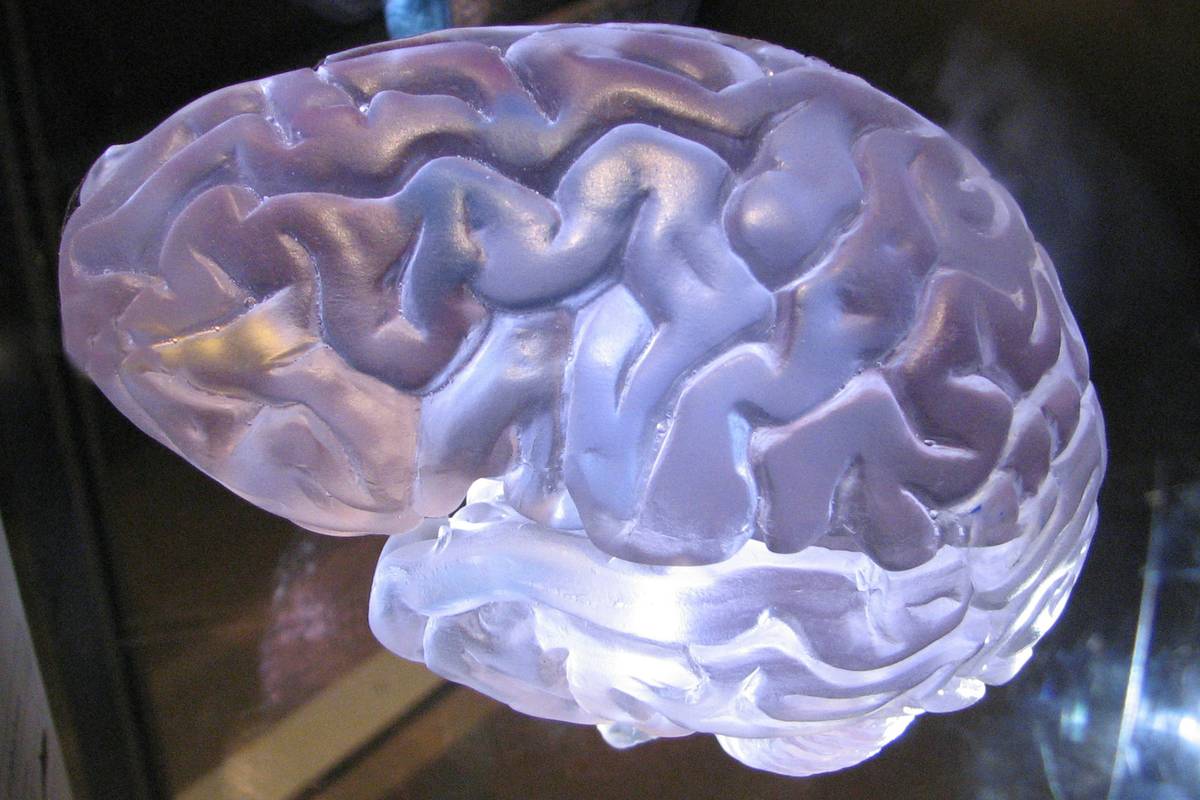 cognitive science psycholinguistic where in brain